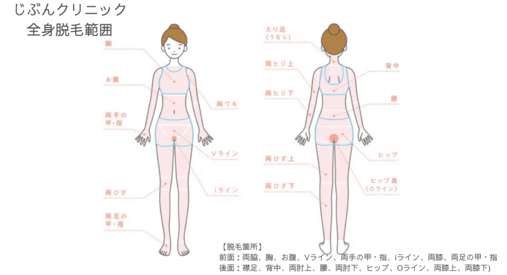 じぶんクリニック全身脱毛・VIO脱毛範囲