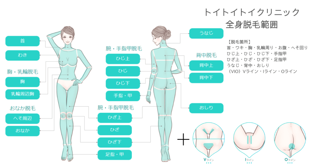 トイトイトイクリニック全身脱毛・VIO脱毛範囲