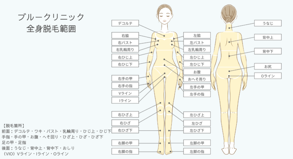 ブルークリニック全身脱毛・VIO脱毛範囲