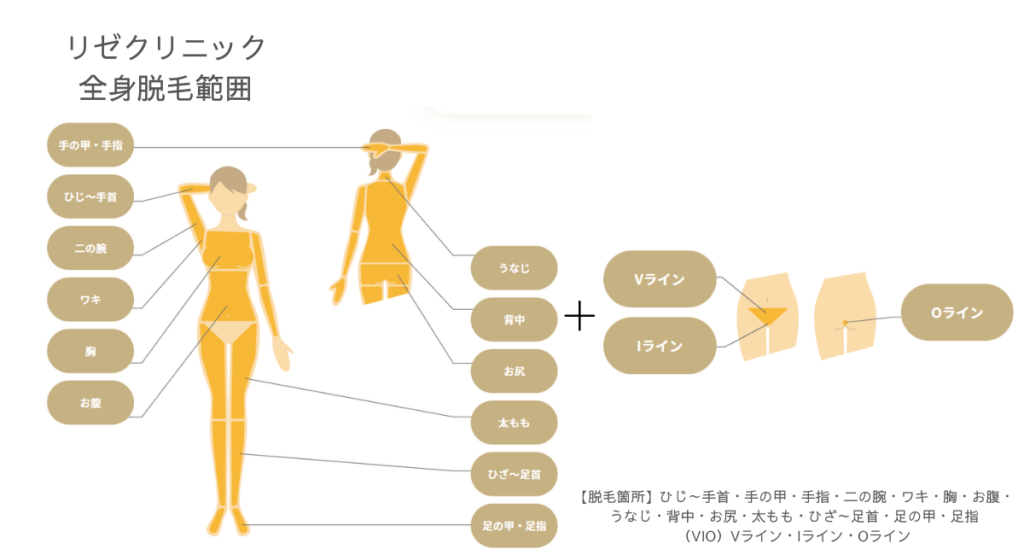 リゼクリニック全身脱毛・VIO脱毛範囲