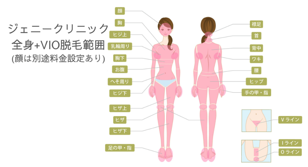 ジェニークリニック全身脱毛・VIO脱毛の脱毛範囲表